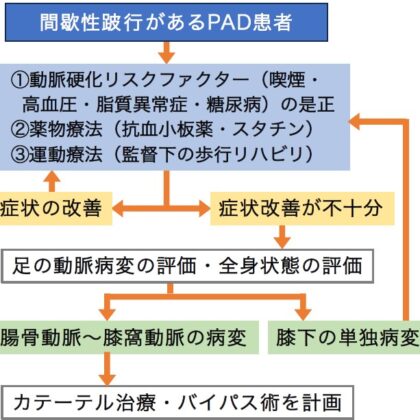 間歇性跛行の治療の流れ